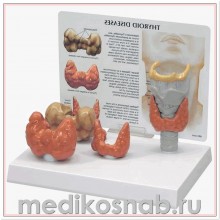 Модель щитовидной железы