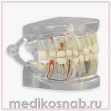 Прозрачная модель челюсти человека с зубами