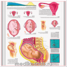 Плакат медицинский Беременность