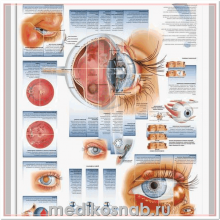 Плакат медицинский Болезни глаз