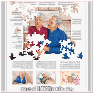 Плакат медицинский Болезнь Альцгеймера