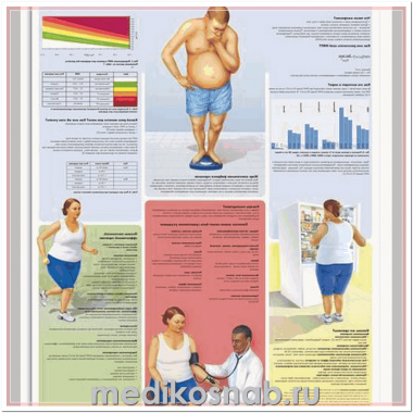 Плакат медицинский Ожирение