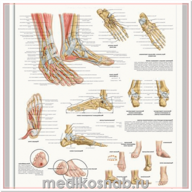 Плакат медицинский Стопа и суставы стопы, анатомия и патология