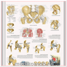 Плакат медицинский Таз и тазобедренный сустав, анатомия и патология