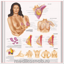 Плакат медицинский Женская грудь, анатомия, патология и самоосмотр