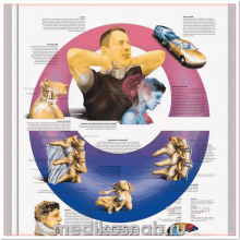 Плакат медицинский Травма ускорения шейного отдела позвоночника